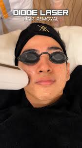 Facial hair! dun ka sa far away! Can’t wait to do more sessions here at the  Willis Clinic and get rid of my unwanted facial hair! ✨😌 #WillisAesthetics  #Facial #DiodeLaser #HairRemoval