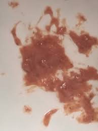 Essen Oder Blut Erbrochen