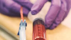 22 years experience hematology and oncology. The Many Faces Of Lymphoma