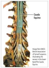 Back front internal organs internal organ system. Fix My Spine The Bay Magazine Swansea
