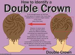 Hormones are also responsible for characteristic changes. 16 Best Hair Growth Patterns Ideas Hair Growth Patterns Hair Hair Growth