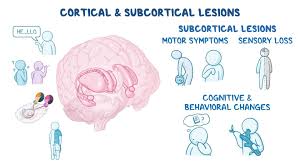 Image result for Neurologic Lesion Localization