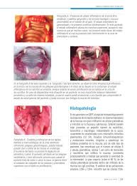 Learn how to say/pronounce faucitis in american english. Actualidades En Medicina Veterinaria Y Zootecnia 14 By Actualidades En Medicina Veterinaria Y Zootecnia Issuu