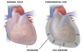 Cocuklarda Gogus Agrisi Neden Olur Prof Dr Taner Yavuz