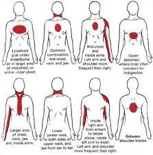 Heart Attack And Stroke To The Rescue