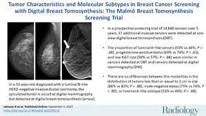 The major categories are the histopathological type, the grade of the tumor, the stage of the tumor, and the expression of proteins and genes. Tumor Characteristics And Molecular Subtypes In Breast Cancer Screening With Digital Breast Tomosynthesis The Malmo Breast Tomosynthesis Screening Trial Radiology