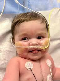 Please pray for my baby boy. He's been having a rough time. He's going  through drug withdrawal quite a bit. The doctor said they will have to wean  him off drugs alot