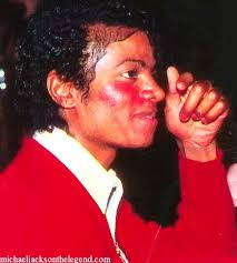 World Vitiligo Day Campaign June 25th, 2013 ! Please Sign The Petition in  Honor Of Michael Jackson !