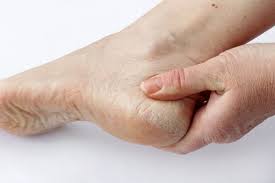 Maybe you would like to learn more about one of these? Kulit Kaki Kering Simptom Punca Diagnosis Rawatannya Ceriasihat