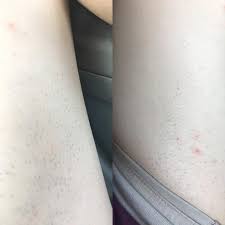 Explore a wide range of the best thick leg on aliexpress to besides good quality brands, you'll also find plenty of discounts when you shop for thick leg during. Please Help My Inner Thigh Back Of Thigh Grow Very Corse And Rough Hair This Is My Thigh In Good Day Thegirlsurvivalguide