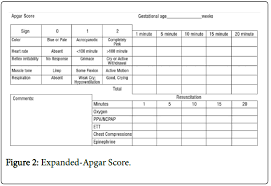 Predictive Factors Of Apgar Scores Below 7 In Newborns Can