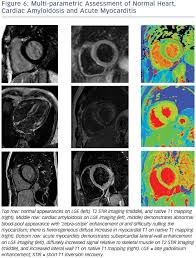 Myocarditides) is a general term referring to inflammation of the myocardium. The Role Of Cardiovascular Magnetic Resonance Imaging In Heart Failure Cfr Journal