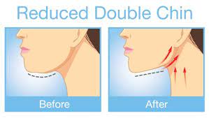 Exercises that get rid of neck fat. How To Get Rid Of A Double Chin 5 Easy Exercises Ndtv Food