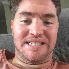 Fundraiser by Sam Devlin : Help get new teeth