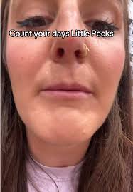 Dot Near Eye Sharpie