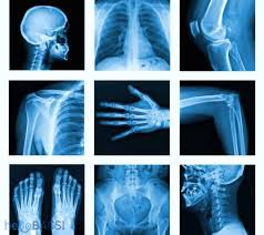 Quy tr&igrave;nh chụp x-quang l&agrave; g&igrave;? chụp x quang bao l&acirc;u c&oacute; kết quả? &bull;