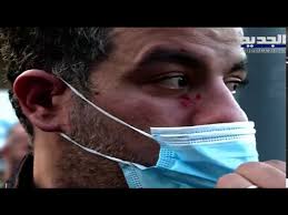 قناة ,امبي ,سي, امبيسي ,فور ,مشاهدة ,تحميل ,حلقة,حلقات ,يوتيوب. Ø¹Ù†ØµØ± Ù…Ù† Ø§Ù„Ø£Ù…Ù† ÙŠØ¹ØªØ¯ÙŠ Ø¹Ù„Ù‰ Ø¥Ø¹Ù„Ø§Ù…ÙŠØ© Ø§Ù„Ø¬Ø¯ÙŠØ¯ ÙˆØ²ÙˆØ¬Ù‡Ø§ Ù‡Ø°Ø§ Ù…Ø§ Ø­ØµÙ„ News Online