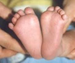 1er tournoi béziers (cwbb) du 10/10/2020. Club Feet Beauchamp Foot Care Beauchamp Foot Care