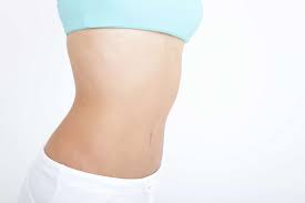 3 how do you get rid of fluid after liposuction? Why Do I Have To Wear A Compression Garment For So Long After Liposuction Mathew Plant