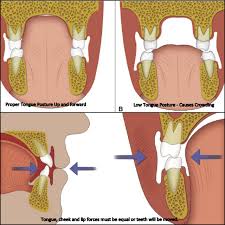 Pin By Fernando Abril On Odontologia Pediatric Dental Family Dental Dentist