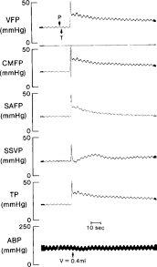 Progressive Ventricular Enlargement In Cats In The Absence