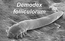 There are two types of demodex brevis lives in the sebaceous glands, while demodex folliculorum lives in the hair follicles. Demodex Folliculorum Wikipedia