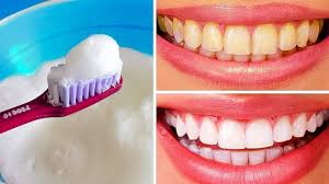 Un método para blanquear los dientes en casa: 10 Formas Naturales De Blanquear Los Dientes Amarillentos En Casa Youtube