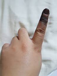 Ambil kulit walnut secukupnya lalu giling atau hancurkan sampai menjadi bubuk. I Love Sarawak Selepas 5 Hari Mengundi Ada Cara Menghilangkan Dakwat Tok Ka Pake Soya Ya Nang Bulak Laa Hurmmmm Jom Like Backup Page I Love Sarawak Disitok Www Facebook Com Ilovesarawakonline Jangan Lupak