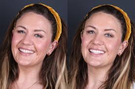See What Cosmetic Dentistry Results Look Like