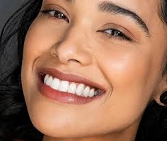 Composite Edge Bonding