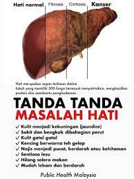 Metastasis adalah situasi dimana kanser telah merebak ke bahagian badan yang lain. Public Health Malaysia Jika Anda Mempunyai Sebarang Gejala Dapatkan Pemeriksaan Lanjut Walaubagaimanapun Kebanyakan Individu Yang Mengalami Masalah Hati Tidak Menyedari Sebarang Gejala Sehinggalah Terjadi Komplikasi Seperti Cirrhosis Dan Kanser