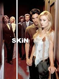 Skin (TV Mini Series 2003–2005) - News - IMDb