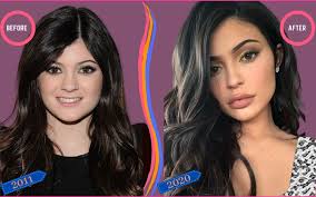 Examples of plastic surgery disasters include lee grant and kim novak. Kylie Jenner Before And After Plastic Surgery Celebscience