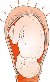 Image result for First Stage of Labor