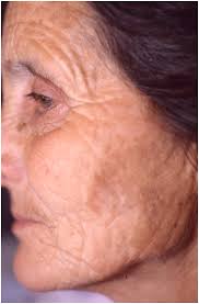 Atti della Accademia Lancisiana