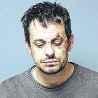 City man faces drug, assault charges
