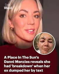 It came the day after she suffered a near-fatal accident 😱 Read more:  https://trib.al/7um8Eru