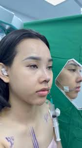 THẨM MỸ VIỆN AONE