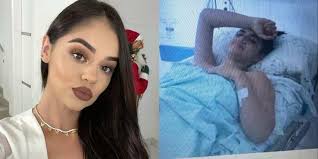La segura publicó fotografía del grave accidente que sufrió. La Segura Actriz Netflix Chichipatos Debut Actriz Influencer Canal 1