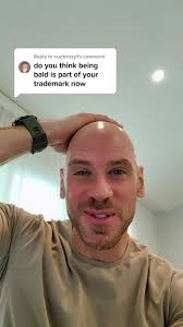 Embracing Baldness: Why Being Bald is Beautiful and Unique