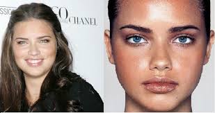 Rhinoplasty Bulbous Tip Google Search Nose Job Adriana Lima Plastic Surgery