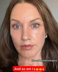 Perde 50 quilos, faz um lifting e ninguém acreditou que fosse a mesma. Veja  o antes e depois