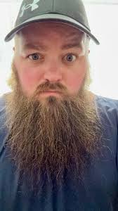 Grow a beard then shave it off and live happily ever after. Yeah except you  forgot the part where I kick your butt.