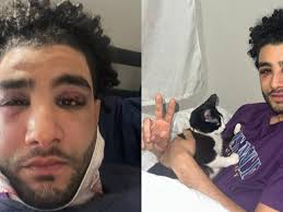 Fundraiser by Omar Jenkins : Support Comedian Adam Hmada's Recovery After  NYC Assault