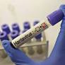 Latin American experts warn region is unprepared for hantavirus threats