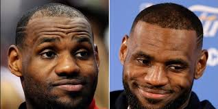 El trasplante de cabello de LeBron James: impacto, técnicas y tendencias  entre las celebridades