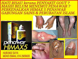Secara mudahnya serangan gout senang berlaku jika anda: Hati Risau Penawar As Syifa Perubatan Islam Alternatif Facebook