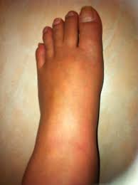 Pin On Crps