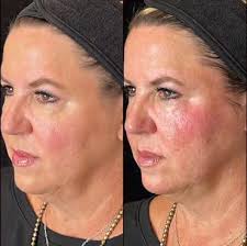 Memphis Health+Fitness Magazine October 2023 by Memphis Health+Fitness