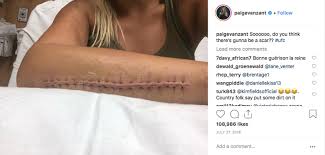 Vanzant was signed to the flyweight division of the ultimate fighting championship. Catching Up With Paige Vanzant Ufc